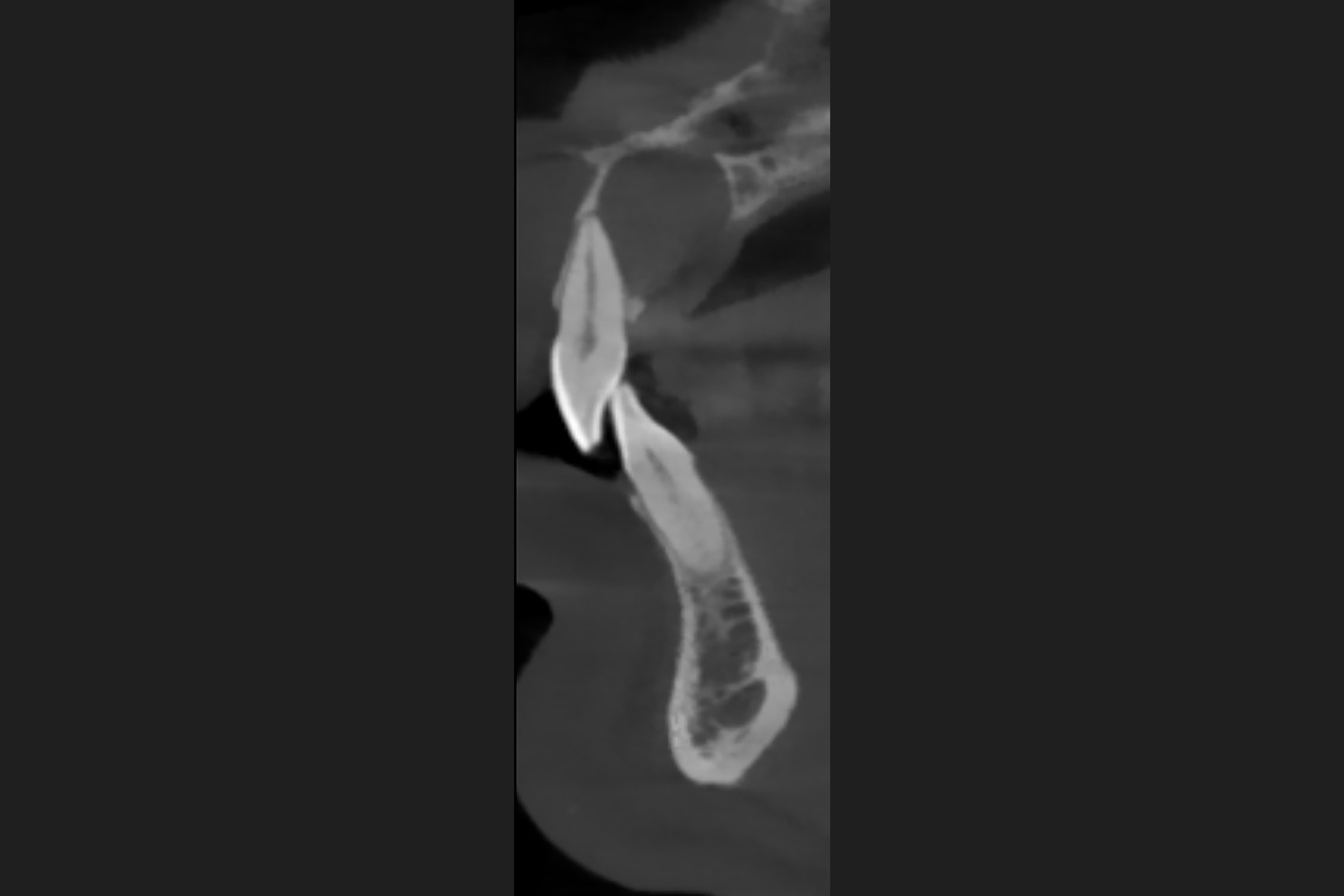blog-post-image